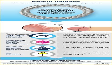 Can you Squeeze Pearly Penile Papules? Be Cautious of Scarring